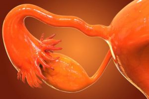 aborto-implantacion