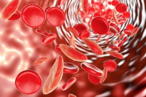 Anemia por deficiencia de hierro