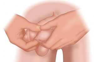 C&oacute;mo hacerse un autoexamen testicular