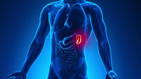 La inflamación del bazo