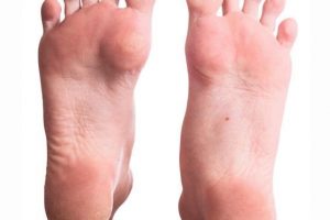 Consejos para prevenir las durezas de los pies