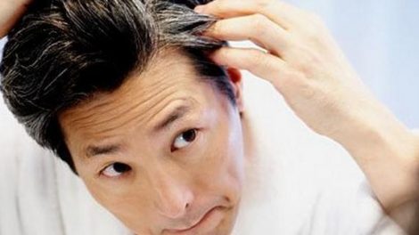 ¿Por qué surgen las canas?