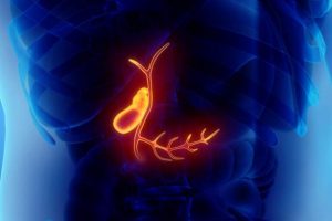 Cirrosis biliar primaria