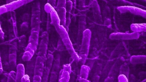 La bacteria Clostridium Novyi podría ayudar contra el cáncer