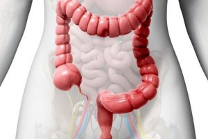Colon inflamado
