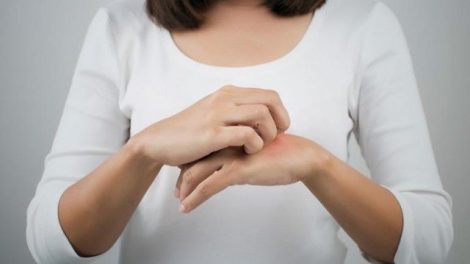 Consejos naturales para aliviar la dermatitis