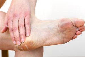 Consejos naturales para aliviar rozaduras de zapatos