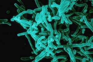 difteria