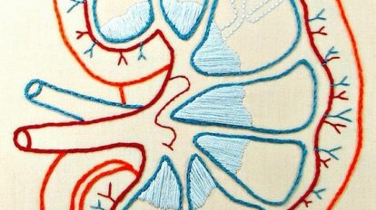 Dolor de riñones: síntomas, causas y tratamiento - Natursan