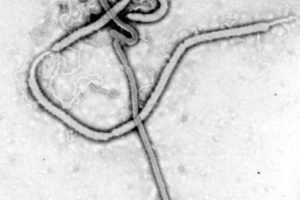 Microscopía electrónica que muestra al Virus Ébola