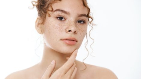 eliminar puntos negros