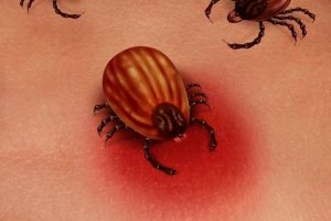 Enfermedades infecciosas por picadura de garrapata