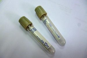 Glucosa