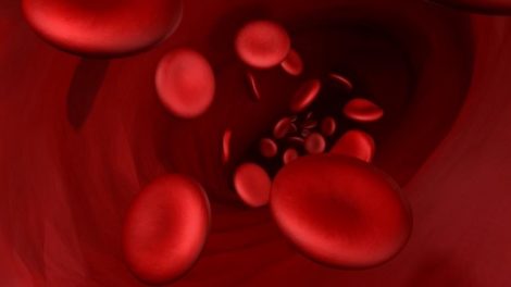 Los síntomas del hierro bajo