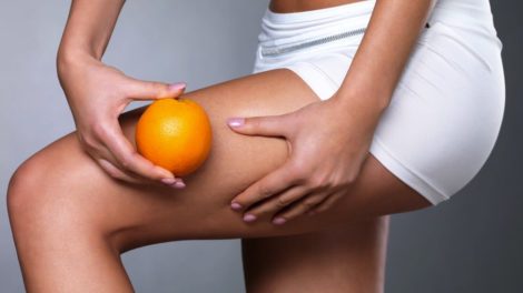 Mitos sobre la celulitis