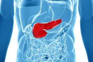 Pancreatitis: la inflamación del páncreas