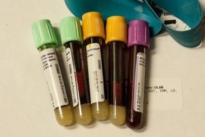 Todo sobre el pH de la sangre