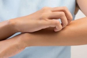 Consejos naturales para aliviar el picor de la piel