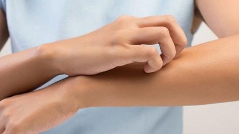 Consejos naturales para aliviar el picor de la piel