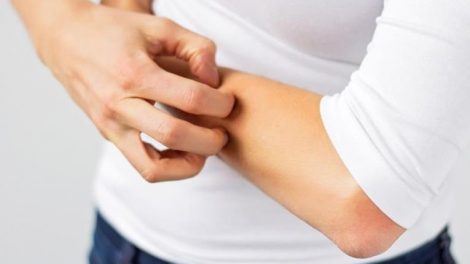 El picor de la piel y por qué cuando nos rascamos nos pica más