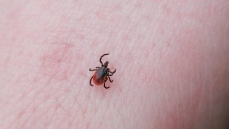 prevenir-picaduras-garrapata
