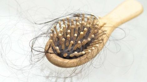 Remedios naturales contra la caída del cabello