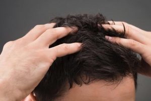 Remedios repelentes naturales contra los piojos