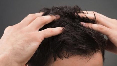 Remedios repelentes naturales contra los piojos