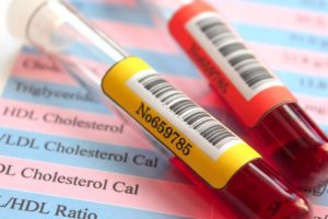 resultados-analisis-de-sangre