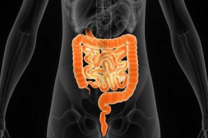 Los signos de una flora intestinal alterada