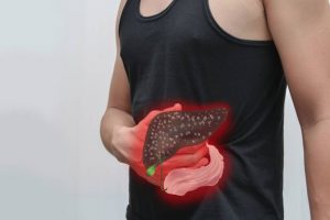 Síntomas de problemas en el hígado