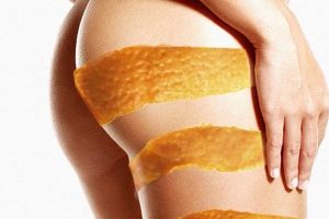 tipos-de-celulitis