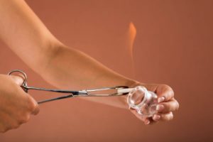 Todo sobre el Cupping para eliminar la celulitis