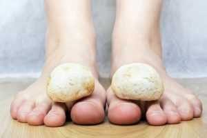 Cómo tratar los hongos en los pies
