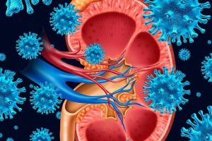 ¿Sabes qué es la uremia?