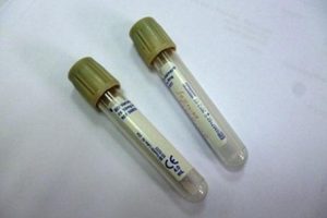 Niveles de prediabetes